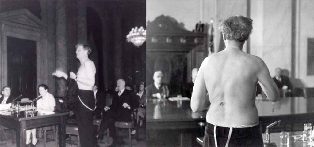 Wurmbrand mostrando sus heridas ante el comité.